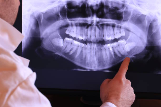 Best Urgent Care for Lost Fillings or Crowns in Westlake, OH